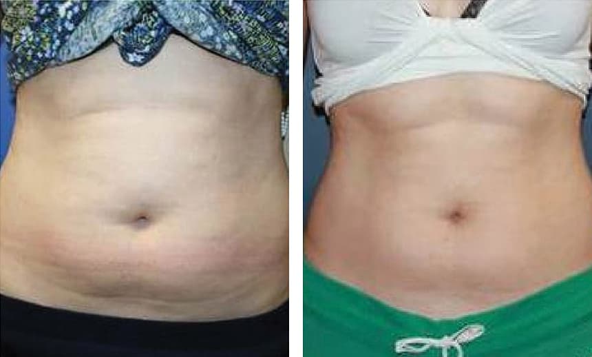 VenusLegacy resultat