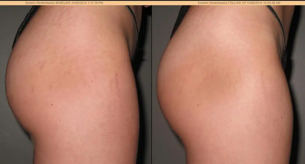 VenusLegacy resultat